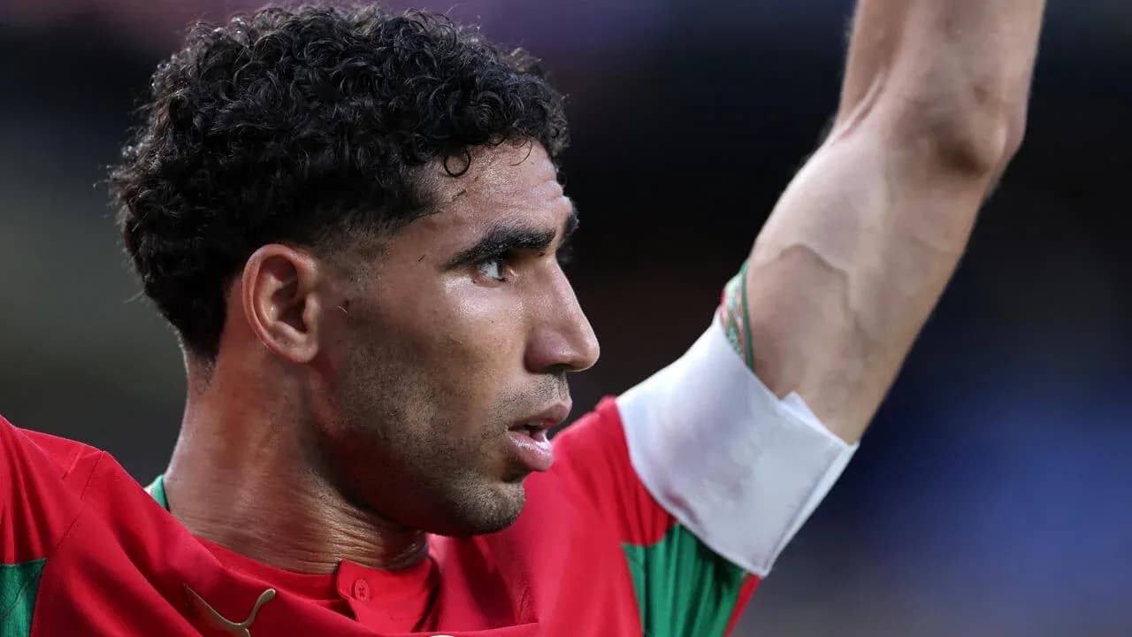 Jugador levantando la mano durante el partido